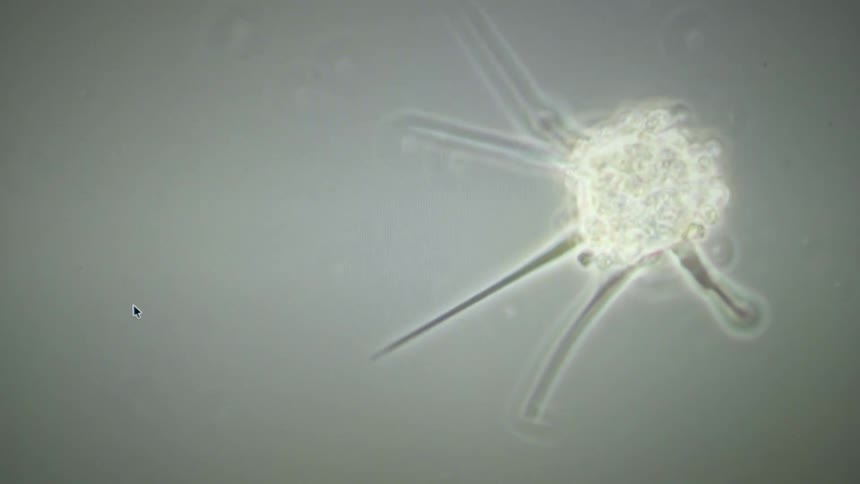 Microscopic footage of a single-celled protozoan organism with long, spiny cilia floating in a liquid medium