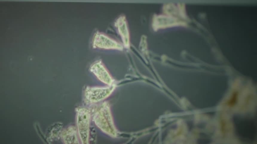 A fascinating microscopic view captures a colony of Vorticella, bell-shaped protozoa, contracting and expanding on their stalks