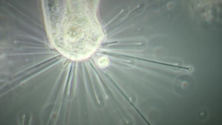 Microscopic view of a suctorian protozoan capturing and consuming its prey with its tentacles
