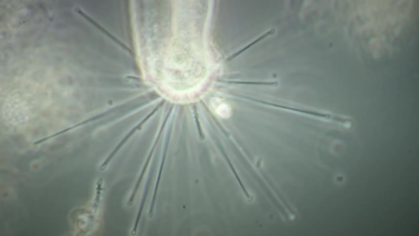 A predatory suctorian protozoan under a microscope uses its radiating tentacles to capture and consume its prey