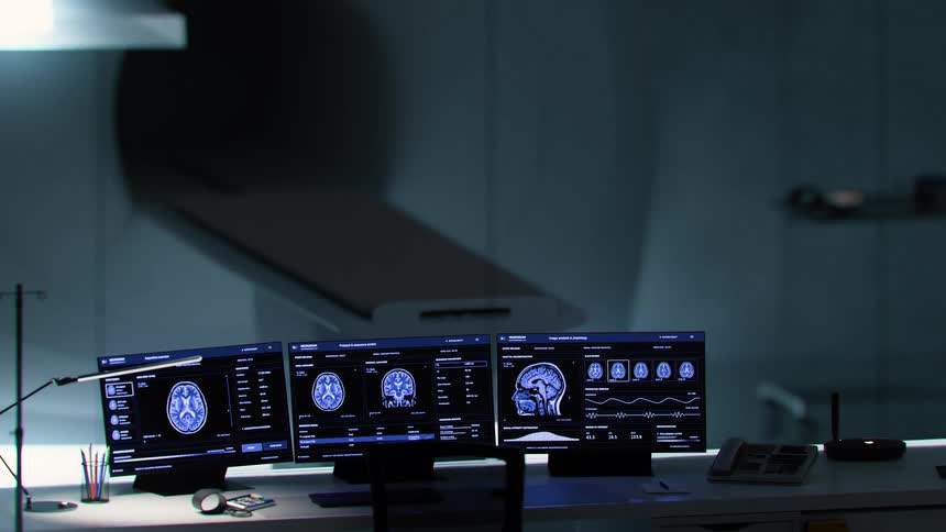 A high-tech medical control room displays detailed brain scans on multiple monitors, with an MRI machine visible and operating in the background
