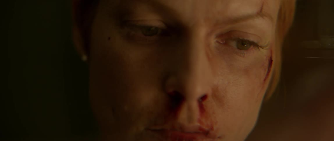 A woman's nose and lip are bleeding