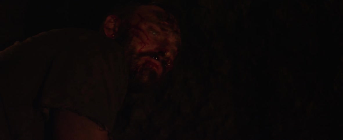 A bleeding man is crying in the dark