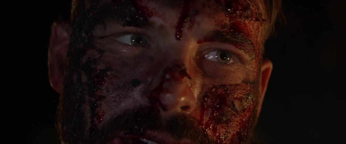 A man is all covered in blood
