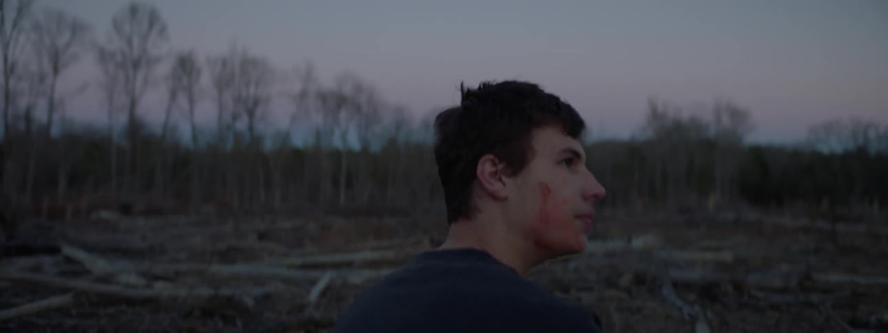A young man bleeding from his cheek stands outside
