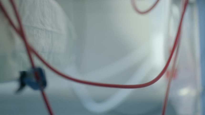 Red string is connecting two white bags