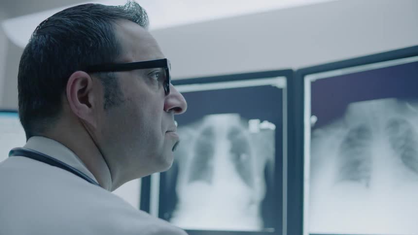 A doctor looks at chest images