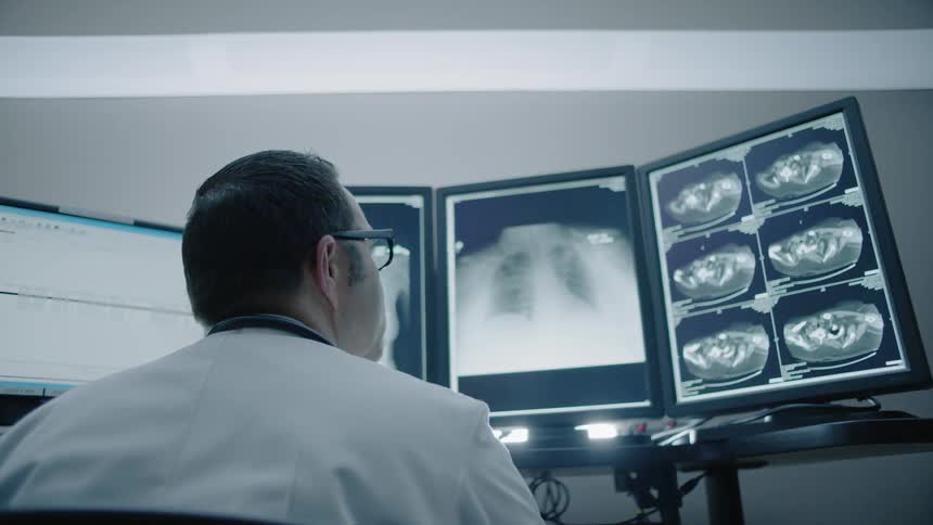 A doctor is looking at x-rays of a person