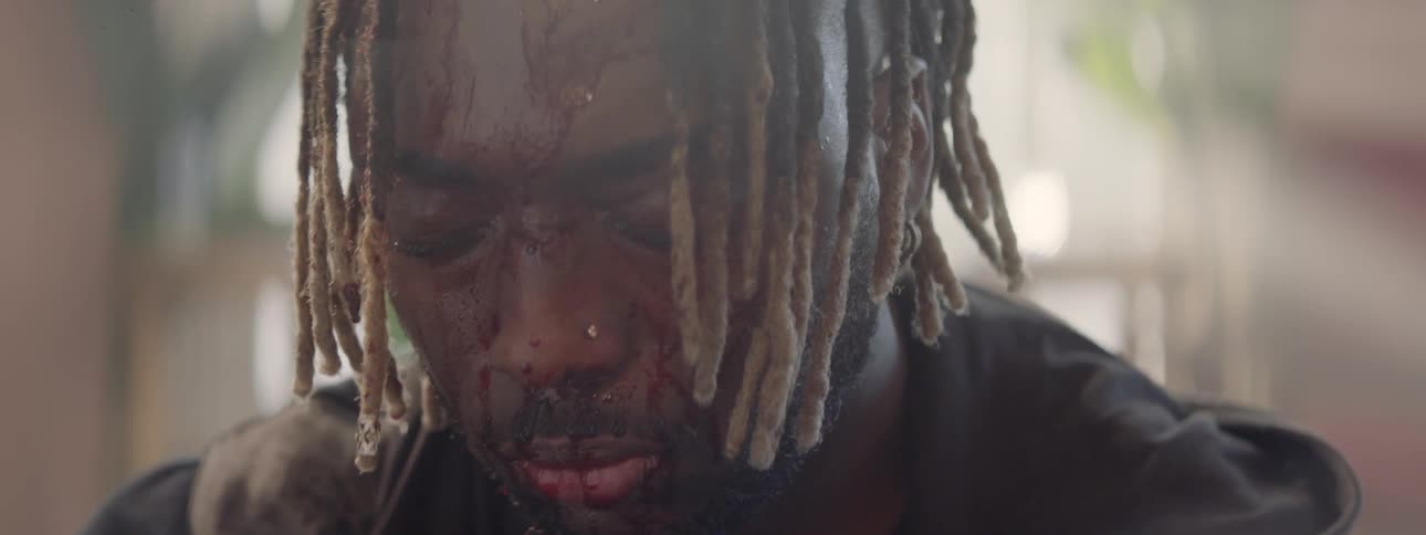 A man with a bloody face is sitting down after a fight
