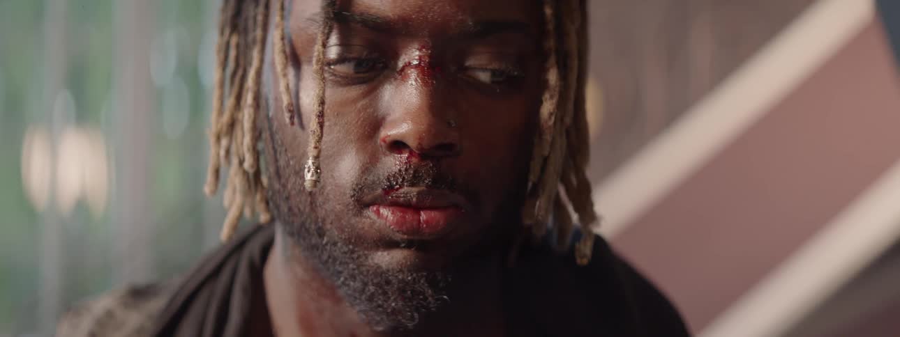 A black man with a cut and bleeding nose