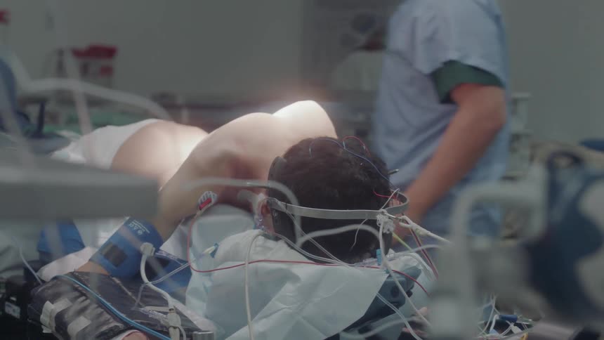 Doctors surrounding a patient in an operating room