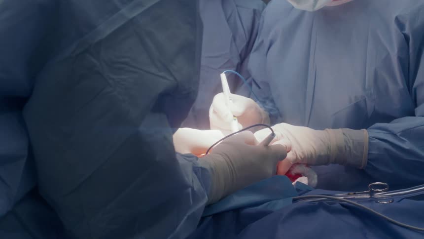 Steam rises from the patient as the surgeons work