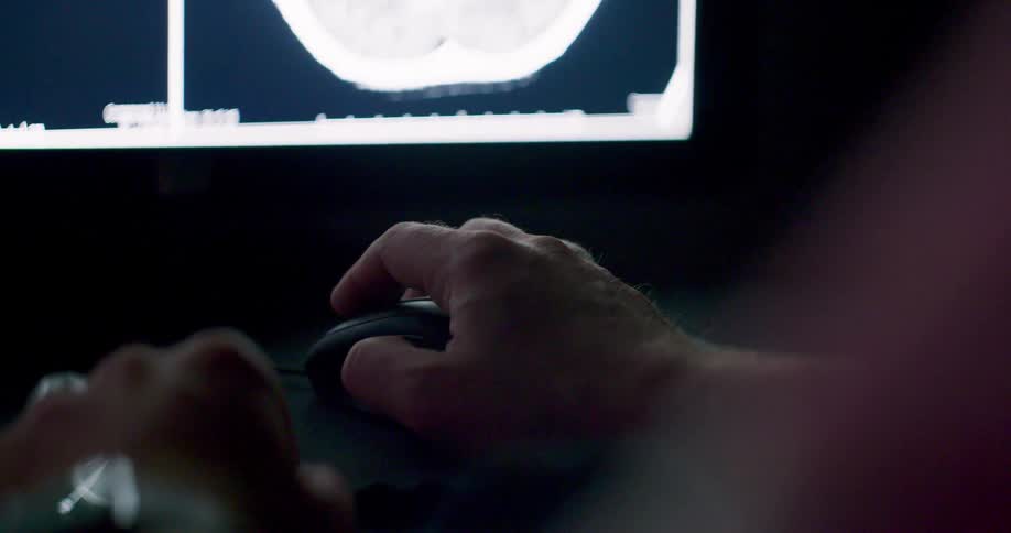 A man using a computer mouse to look at x-ray images on a screen in a dark room