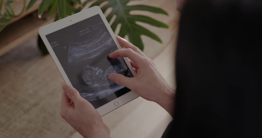 Woman looks at an ultrasound of a baby on a tablet