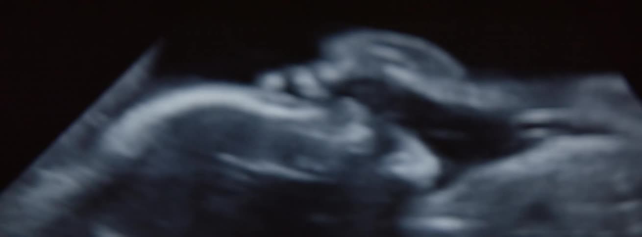 An ultrasound of a baby in the womb