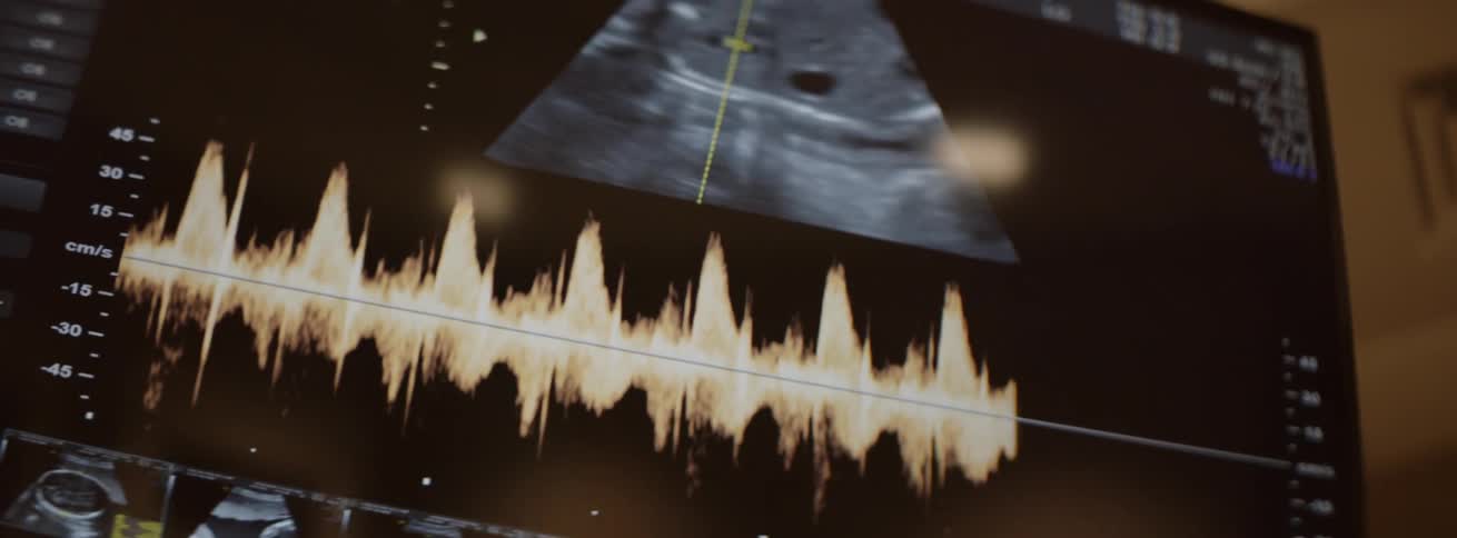 A sonogram is displayed on the screen