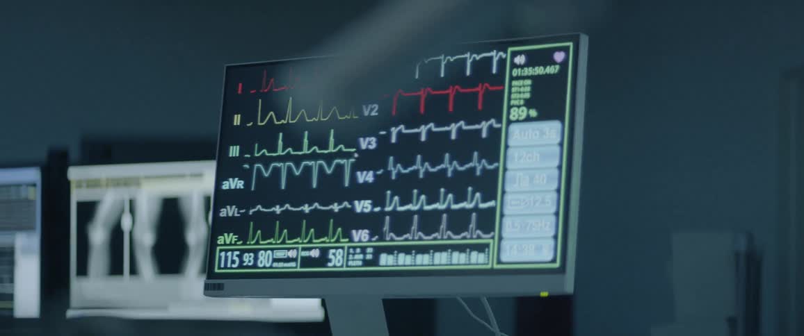 Patient vitals are displayed on a computer monitor in a hospital