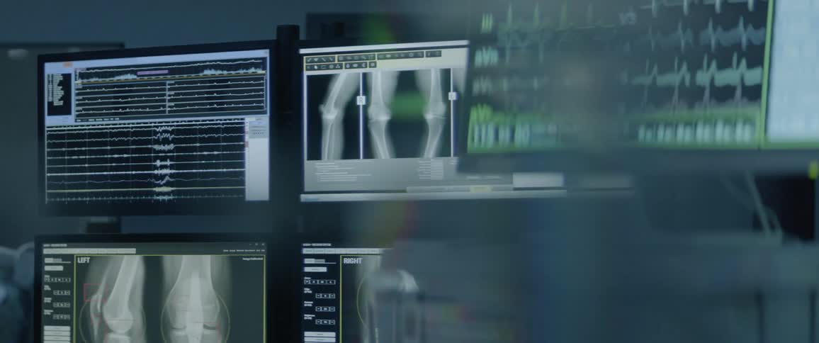 Pictures of x rays in a dim room