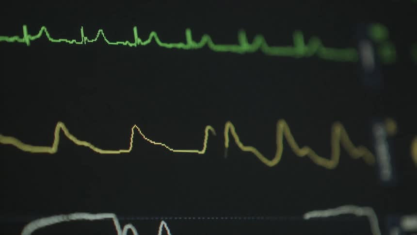 View of a electronic screen with a monitor running