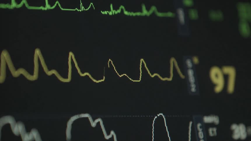 Hospital equipment showing vital signs