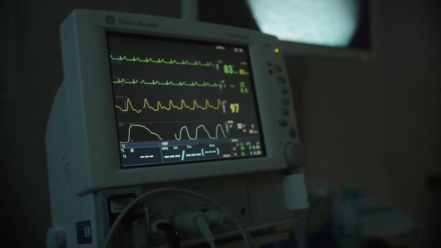 A close up shot of a heart rate monitor in the hospital