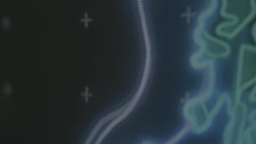 Lines on a computer screen