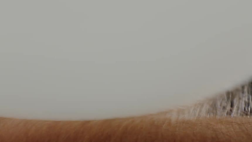 Static Electricity On A Person's Arm