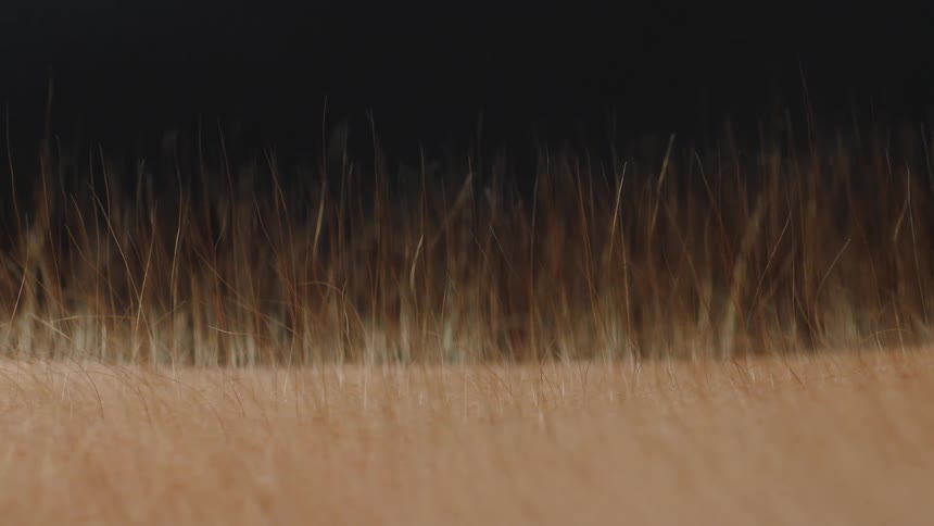 Static Electricity On A Person's Arm