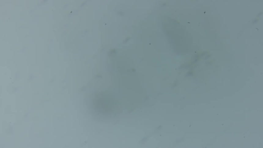 Microscopic cells patterns and shapes flashing by