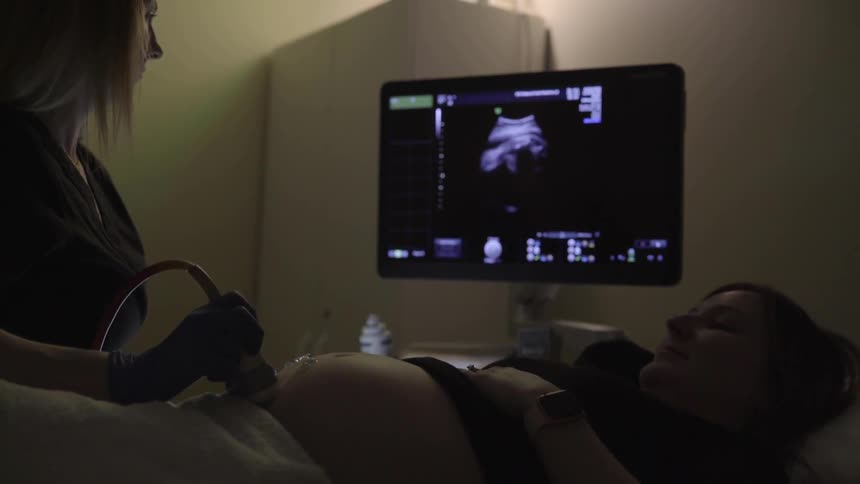 Nurse conducts an ultrasound on a pregnant woman