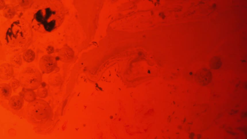 A red substance moves in a liquid