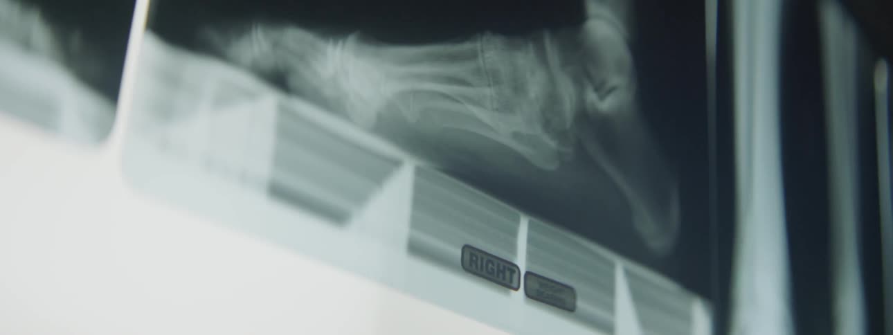 An x ray of a foot is displayed