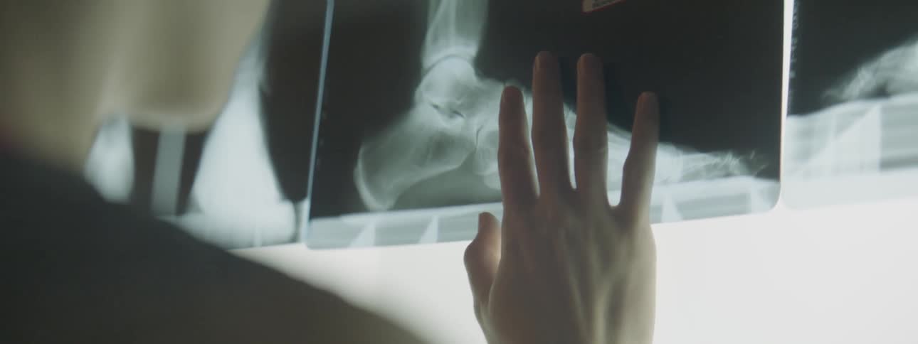 A person is examining an x ray