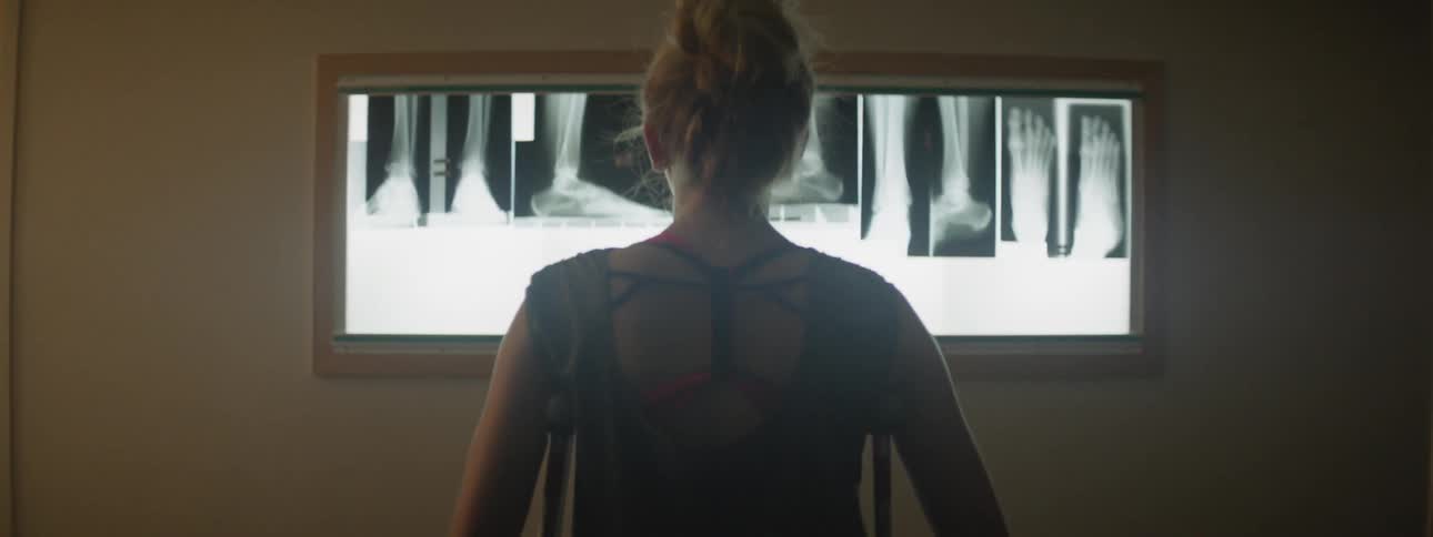 A woman on crutches stands and looks at x rays