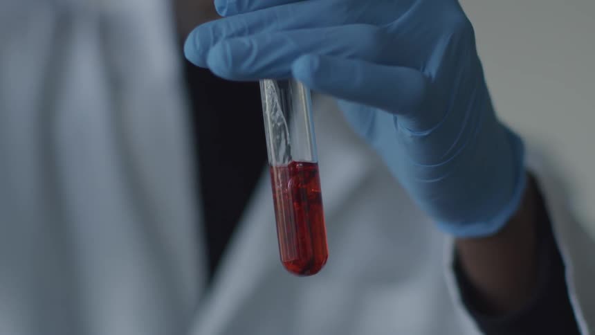 A black chemist pouring a clear liquid into a vial containing blood