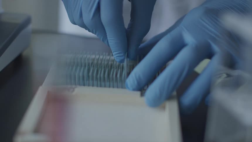 A person wearing latex blue gloves put lab samples in a slot in a tray