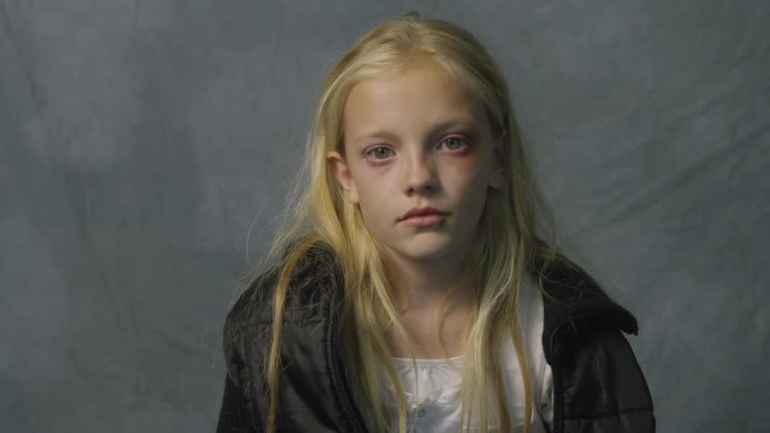 Girl with puffy eyes blinking in front of a gray background