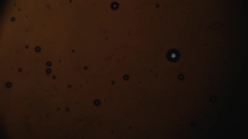 Dark spots floating in liquid