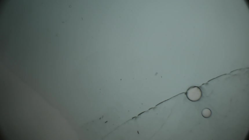 Black spots and bubbles float in the water